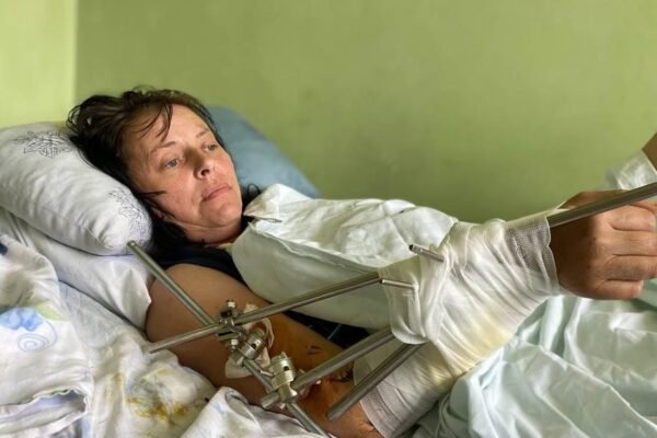 У  Львові хірурги врятували ногу жінці з Бахмута