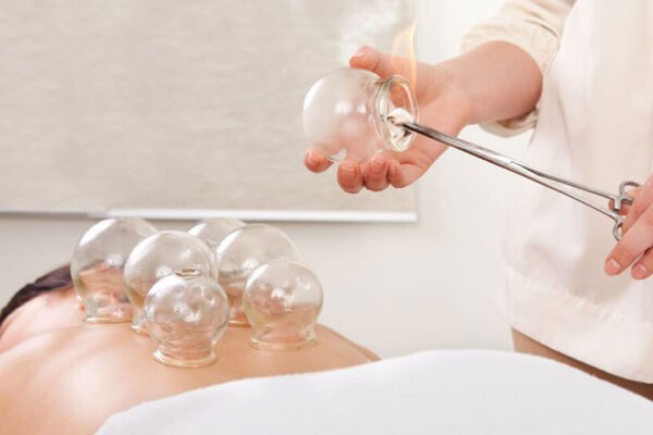 В Івано-Франківську масажистка випадково підпалила клієнтку. Потерпіла померла в лікарні