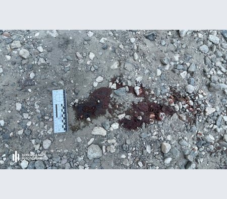 На Одещині подружжя поліцейських автівкою двічі переїхало бабусю і покинуло помирати на лавці (ВІДЕО)