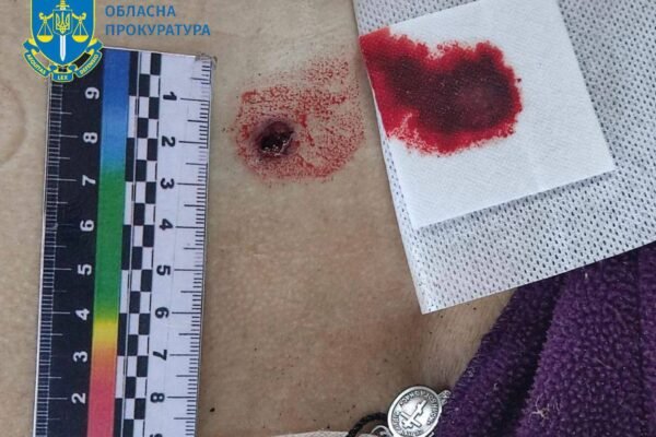 Окупанти вдарили по прикордонню Сумщини: Загинула жінка