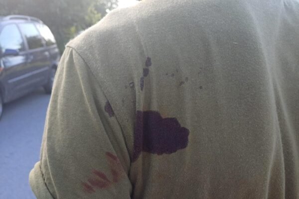 На Хмельниччині чоловік з ножем напав на працівника ТЦК