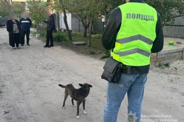 В Сумах собака пошматувала обличчя 4-річній дитині