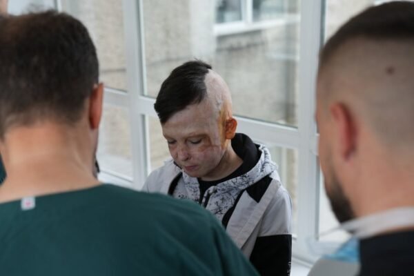 У Львові провели 36-ту операцію хлопчику з опіками після ракетного удару по Вінниці