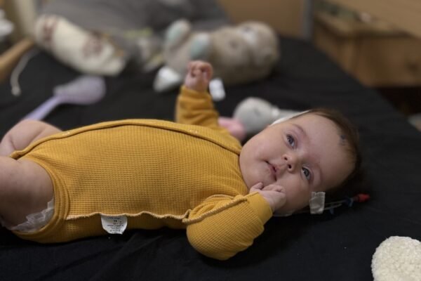 Львівські нейрохірурги врятували двомісячне немовля з пухлиною мозку