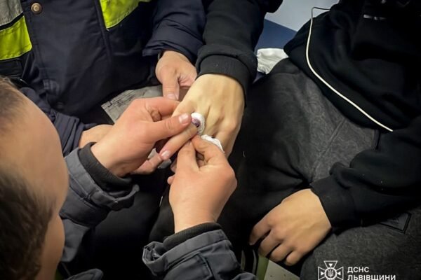 У Львові 15-річний хлопець ледь не втратив палець через тісну каблучку