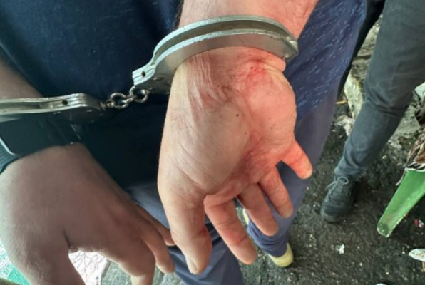 У Черкасах чоловік під час застілля вдарив знайому ножем у спину та ліг відпочивати