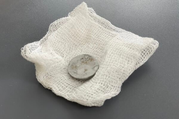 У Львові врятували дворічну дівчинку, яка кілька місяців жила з батарейкою у стравоході