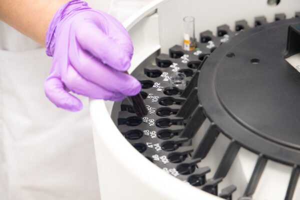 У Києві зареєстрували понад 9000 випадків захворюваності на грип і ГРВІ