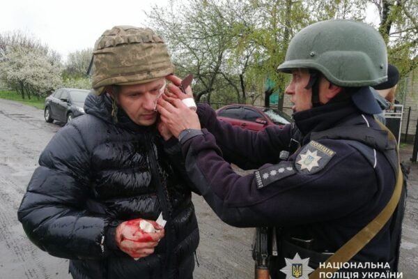 На Дніпропетровщині п’ятеро поліцейських отримали поранення внаслідок вибуху гранати