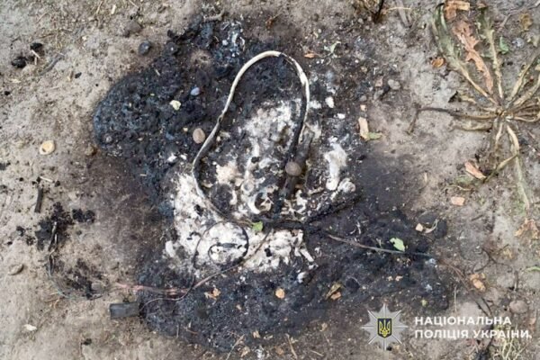В руках 11-річної дитини на Хмельниччині здетонував вибуховий пристрій