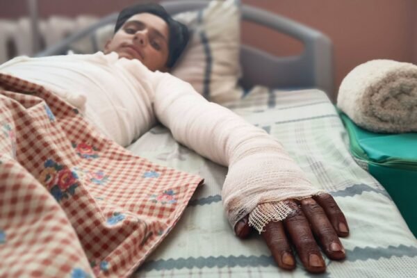 У Львові медики рятують підлітка з Одеси, який отримав 45% опіків шкіри під час селфі на даху електрички