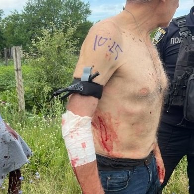 В Конотопі правоохоронці врятували життя важко пораненому чоловіку