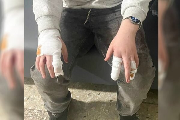 На Рівненщині ротвейлер покусав двох дітей